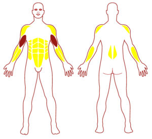 Pictogramme illustrant les groupes musculaires sollicités par l'utilisation de cet équipement. FITPARK